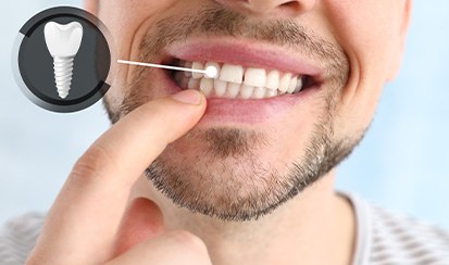 A patient pointing to his dental implant restoration