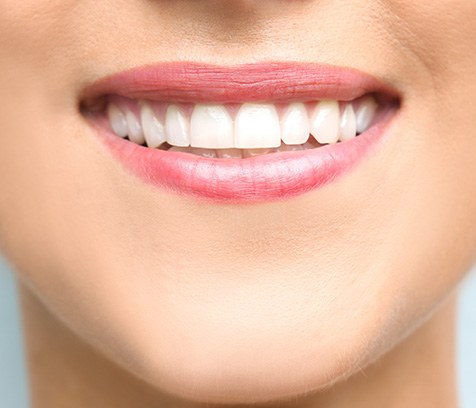 a close-up of teeth after receiving cosmetic bonding 