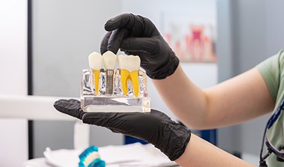 a close-up of a dental implant model