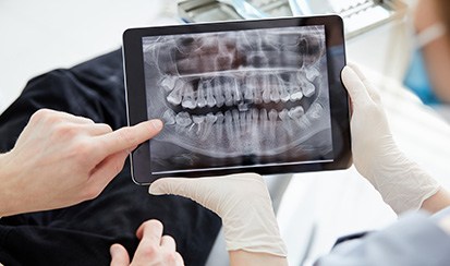 a dentist and patient looking at an X-ray