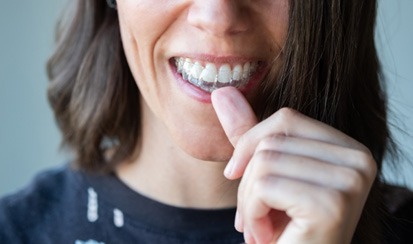 a patient inserting her Invisalign aligner