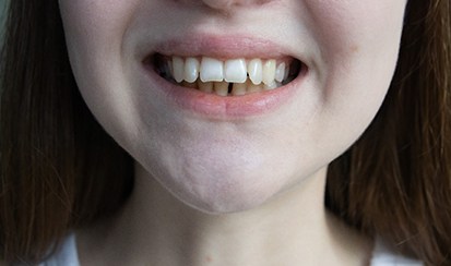 a close-up of a patient with a gap between their front teeth